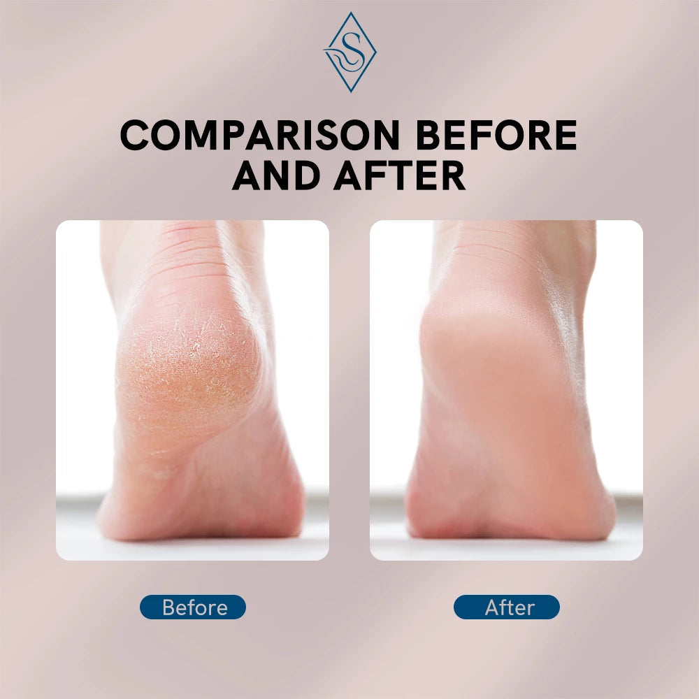 CozyCazza™ Electric Foot File